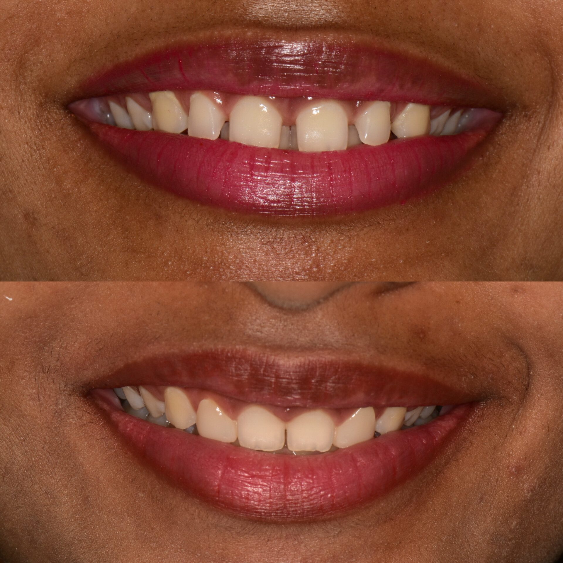 Smile transformation